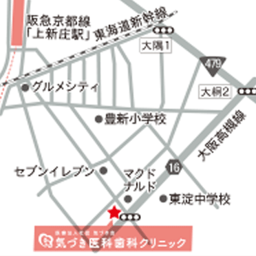 大阪地図